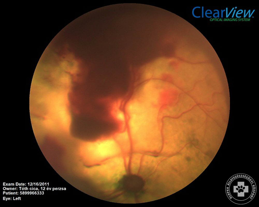 retina vizsgálat)